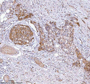 Anti-HAGH Antibody