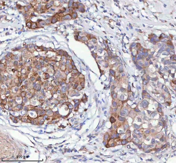 Anti-HAGH Antibody