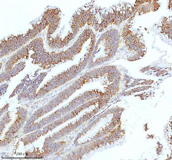 Anti-HAGH Antibody