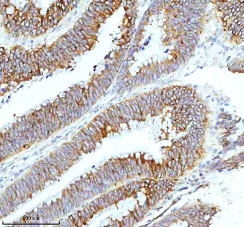 Anti-HAGH Antibody
