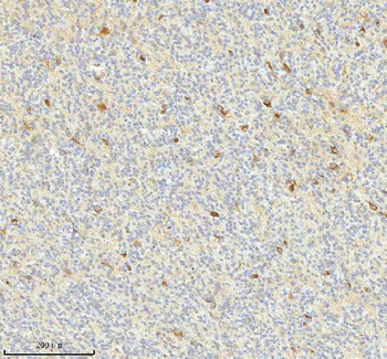 Anti-HAGH Antibody