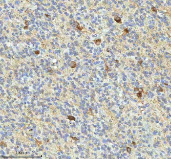 Anti-HAGH Antibody