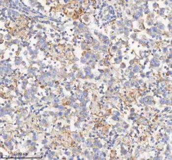 Anti-HADHB Antibody