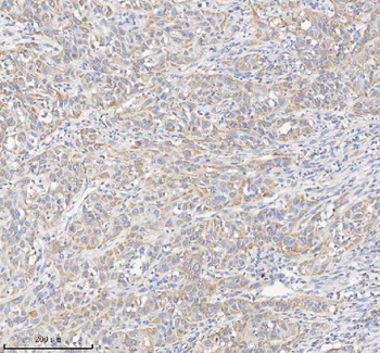 Anti-HADHB Antibody