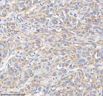 Anti-HADHB Antibody