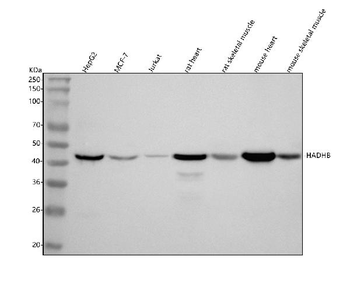 Anti-HADHB Antibody