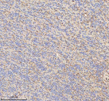Anti-HADHB Antibody