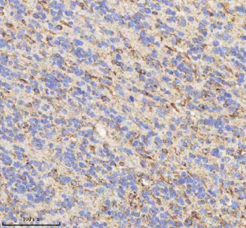 Anti-HADHB Antibody