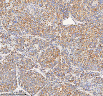 Anti-HADHB Antibody