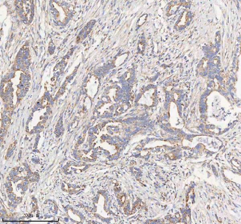 Anti-HADHB Antibody