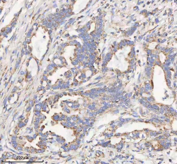 Anti-HADHB Antibody