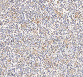 Anti-HADHB Antibody