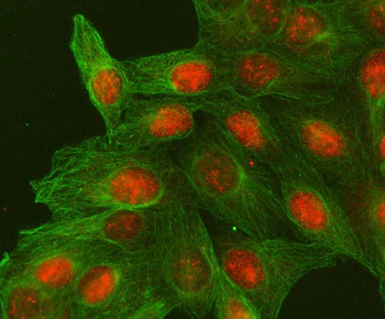 H2AFY2/MACROH2A2 Antibody