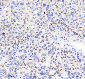 H2AFY2/MACROH2A2 Antibody