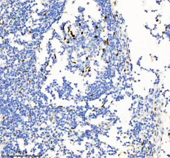 H2AFY2/MACROH2A2 Antibody