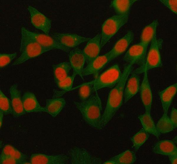 Anti-H2AFY/MACROH2A1 Antibody