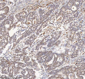Anti-H2AFY/MACROH2A1 Antibody