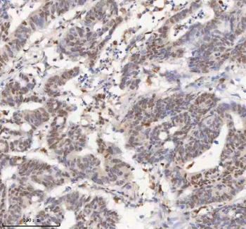 Anti-H2AFY/MACROH2A1 Antibody