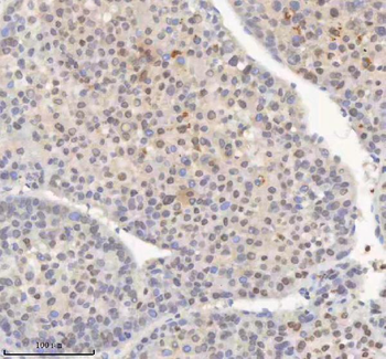 Anti-H2AFY/MACROH2A1 Antibody