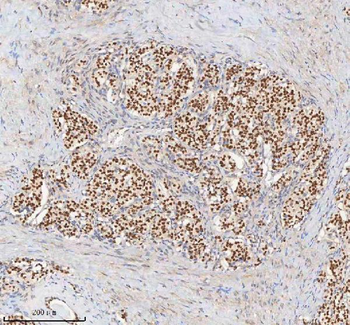 Anti-H2AFY/MACROH2A1 Antibody