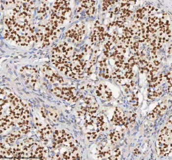 Anti-H2AFY/MACROH2A1 Antibody