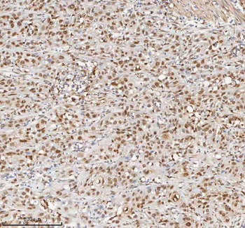 Anti-H2AFY/MACROH2A1 Antibody