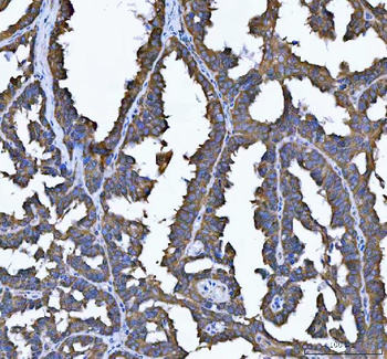 Anti-SEC61G Antibody