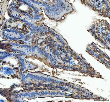 Anti-SEC61G Antibody