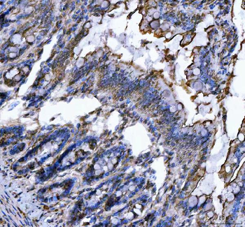 Anti-SEC61G Antibody