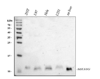 Anti-SEC61G Antibody