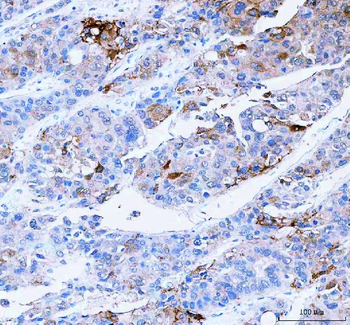 Anti-SCD Antibody