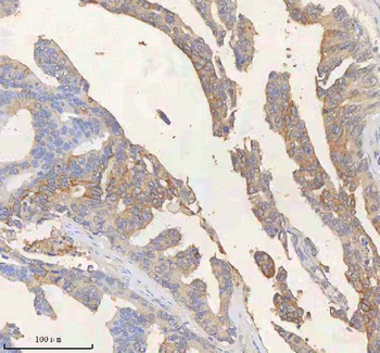Anti-SCD Antibody