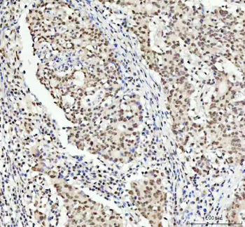 Anti-TDP-43/TARDBP Antibody