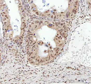 Anti-TDP-43/TARDBP Antibody
