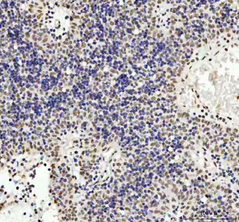 Anti-TDP-43/TARDBP Antibody
