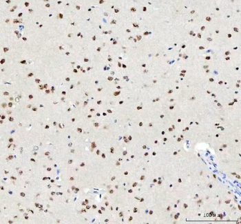 Anti-TDP-43/TARDBP Antibody