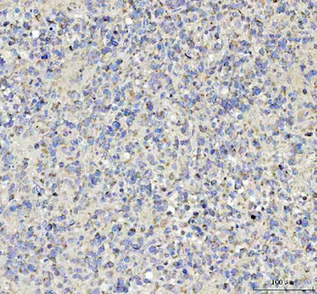 Anti-Tenascin-R TNR Antibody