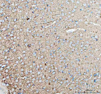 Anti-Tenascin-R TNR Antibody