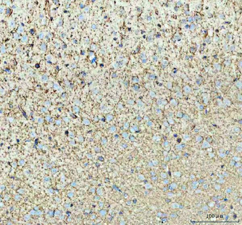 Anti-Tenascin-R TNR Antibody
