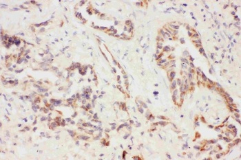 Anti-Eotaxin 3/CCL26 Antibody