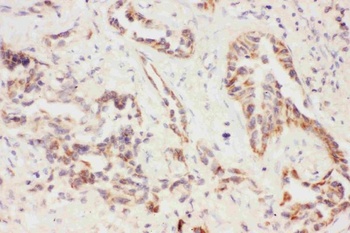 Eotaxin 3/CCL26 Antibody