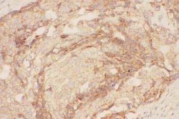Anti-Eotaxin 3/CCL26 Antibody