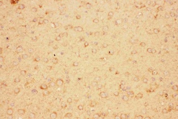 Anti-CNTF Antibody