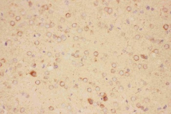 Anti-CNTF Antibody