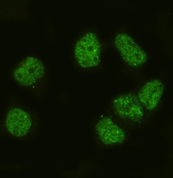 Anti-p27 KIP 1/CDKN1B Antibody