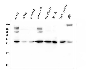 Anti-VEGF/VEGFA Antibody