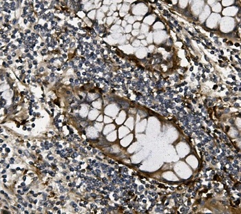 Anti-VEGF/VEGFA Antibody