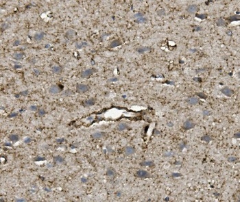 Anti-VEGF/VEGFA Antibody