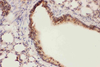 15 Lipoxygenase 1/ALOX15 Antibody