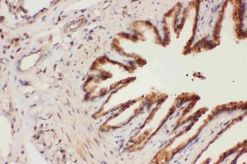 15 Lipoxygenase 1/ALOX15 Antibody